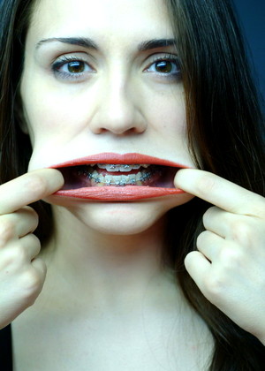 Beautyandbraces Model