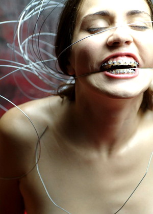 Beautyandbraces Model