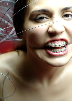 Beautyandbraces Model