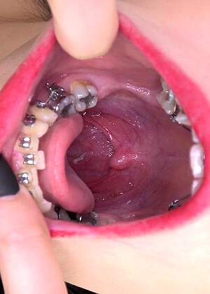 Inside My Mouth