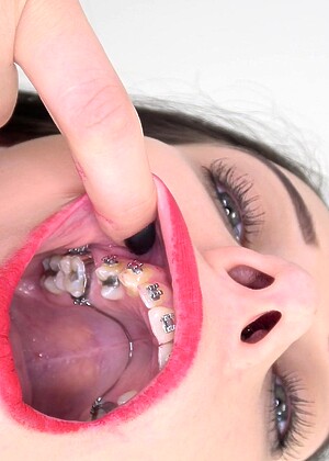 Insidemymouth Model