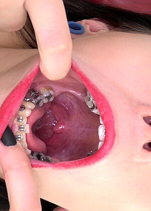 Inside My Mouth 