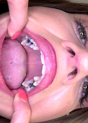 Insidemymouth Model