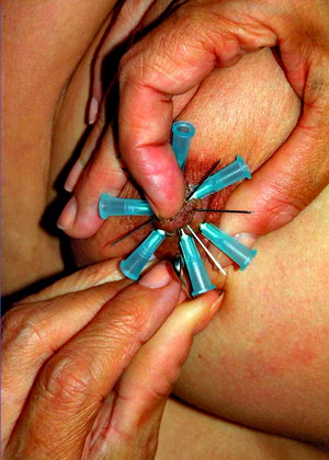 Needle Punishments
