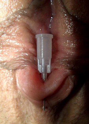 Clitoris Needle Pain